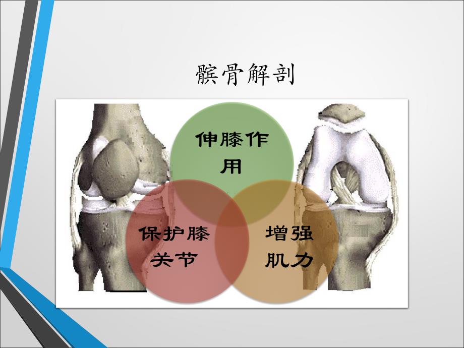 髌骨骨折原因及护理医学ppt_第4页