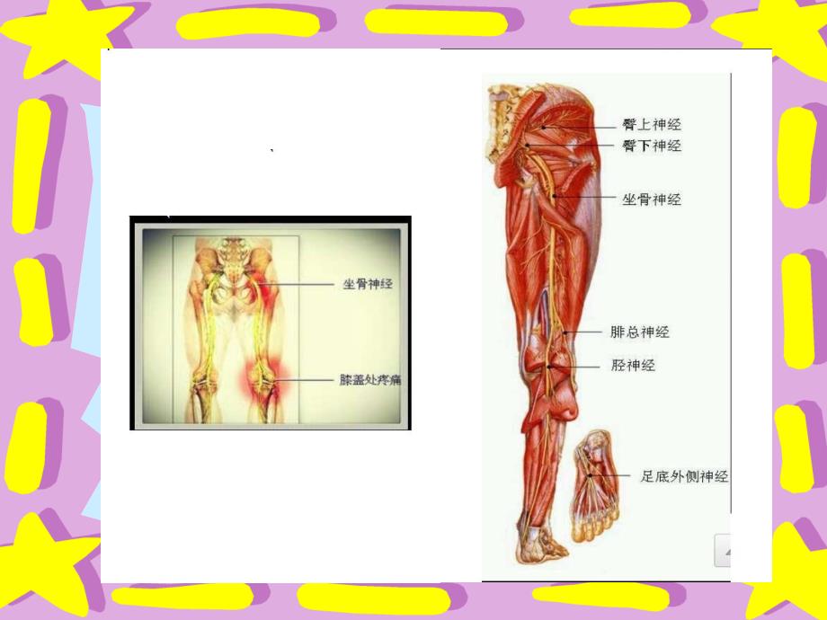 坐骨神经损伤课件_第3页