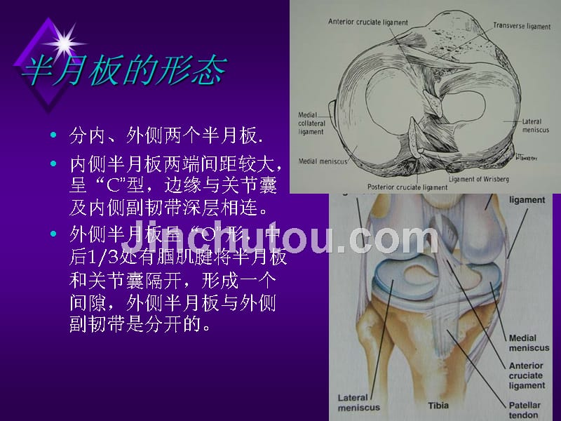膝关节半月板损伤剖析课件_第3页
