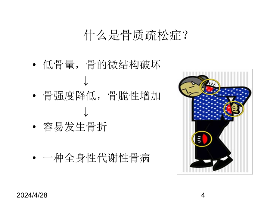 骨质疏松最新医学_第4页