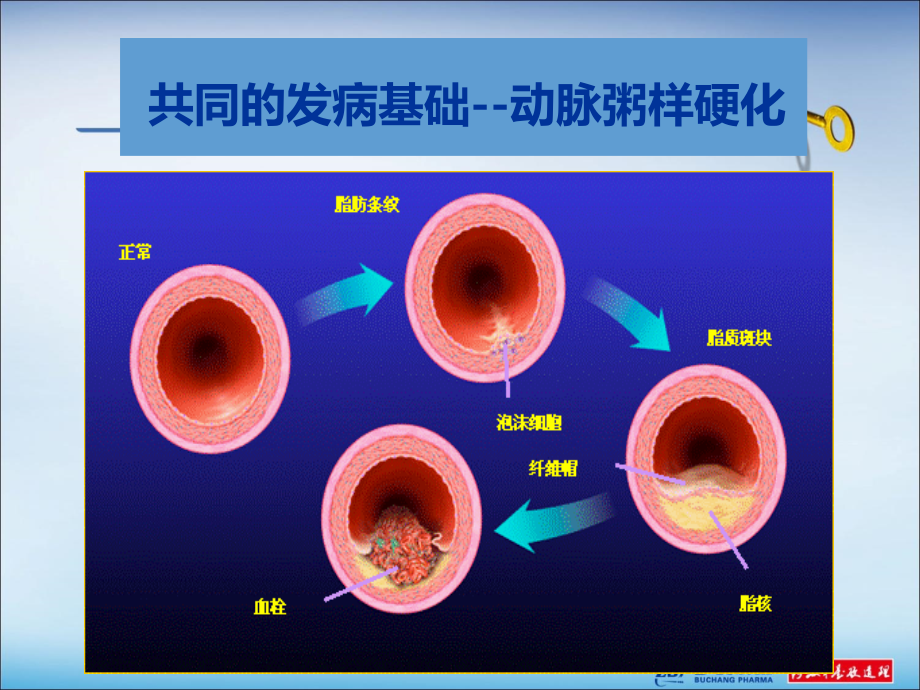 脑心通学术会参考ppt课件_第3页