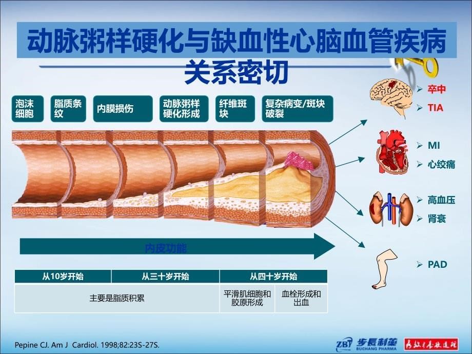 脑心通学术会参考ppt课件_第5页