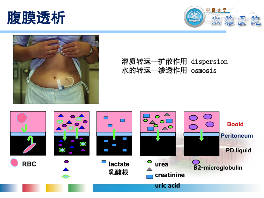 改善腹膜透析效能的策略ppt课件_第2页