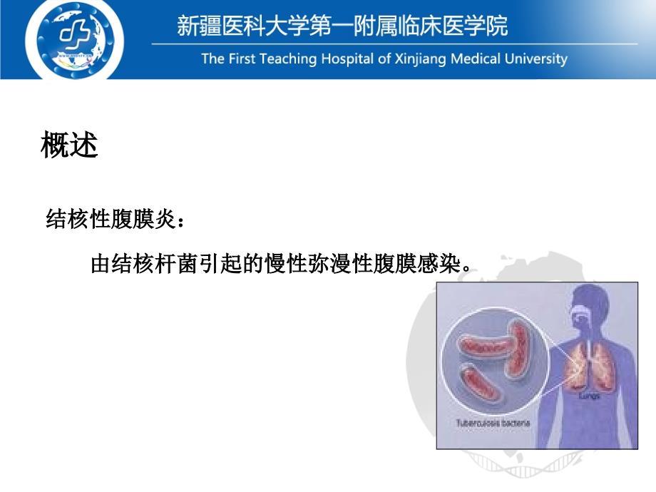 自学结核性腹膜炎ppt模板课件_第4页