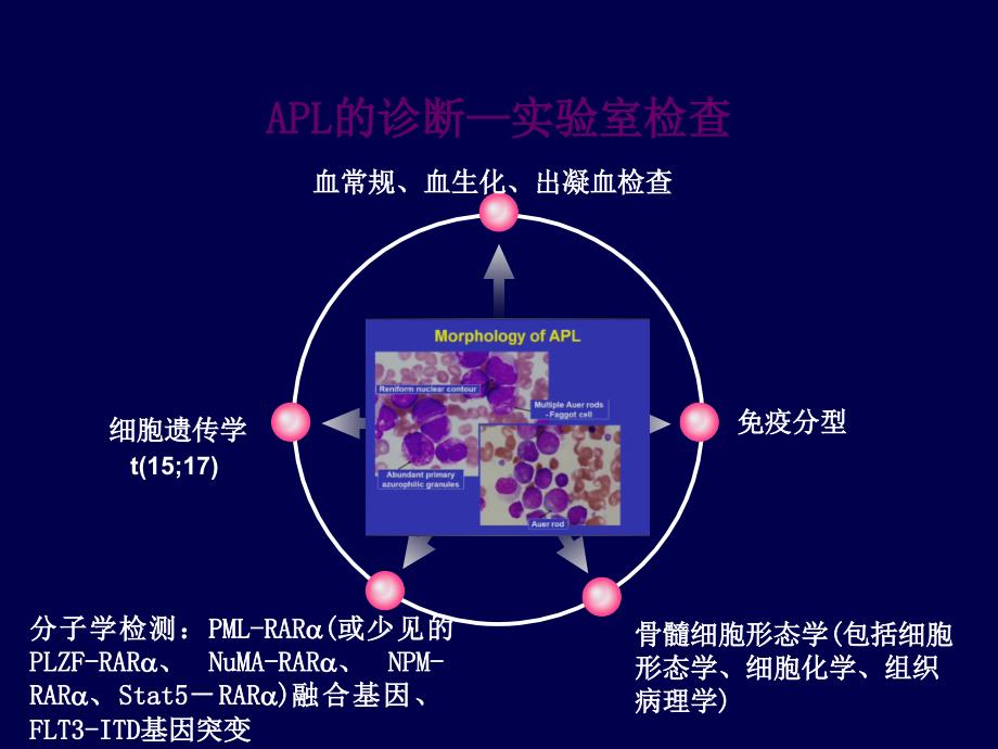 医学课件急性早幼粒细胞白血病指南变迁及临床研究_第2页