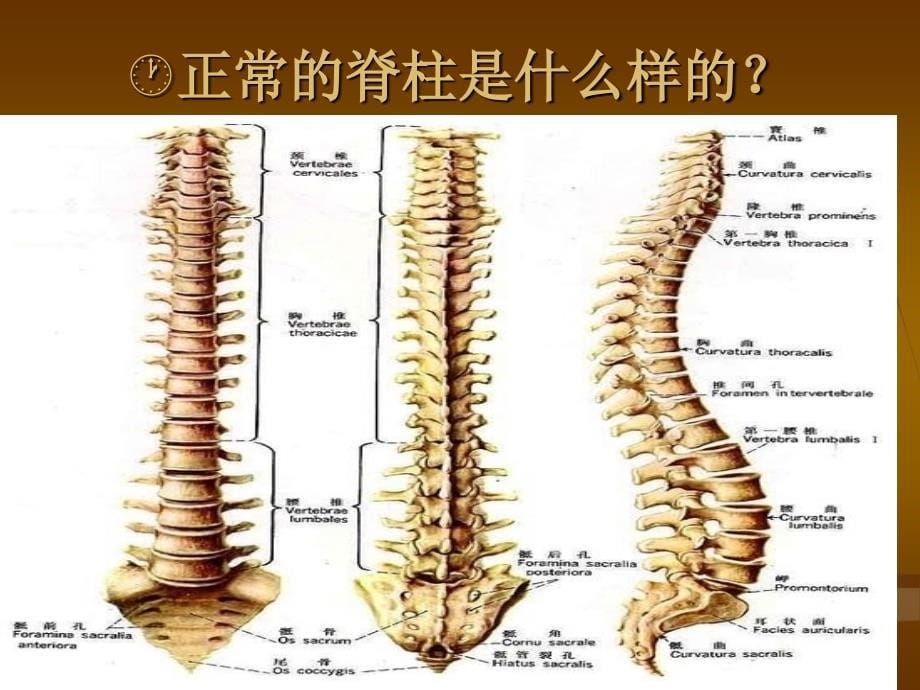 腰间盘突出z=症_【ppt课件】_第5页