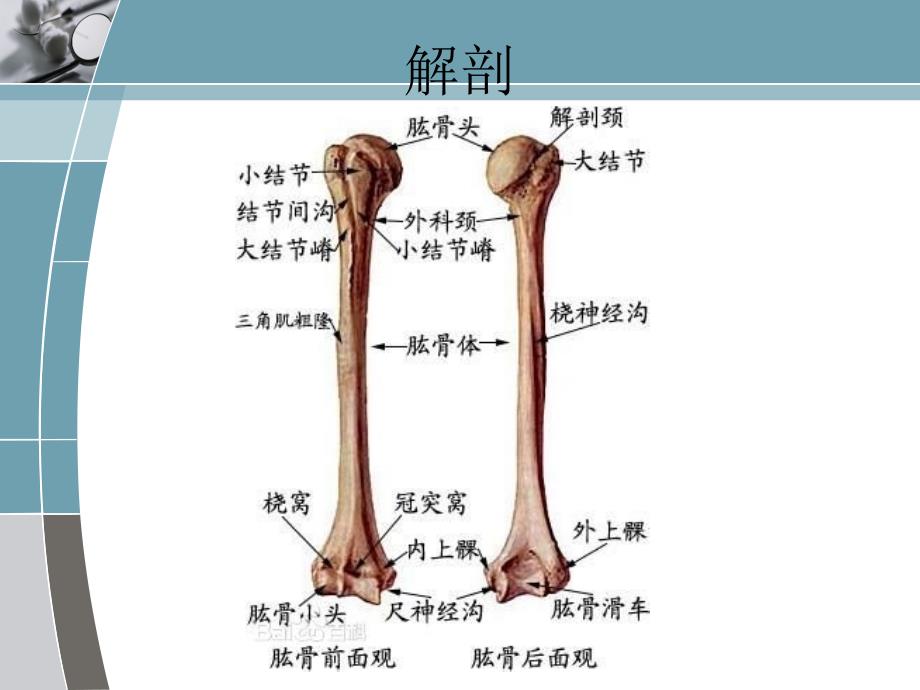 肱骨干骨折手术配合ppt课件_第3页