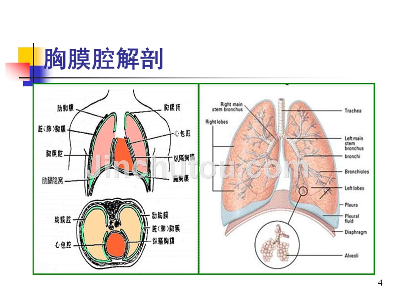 气胸胸腔积液ppt课件_第4页