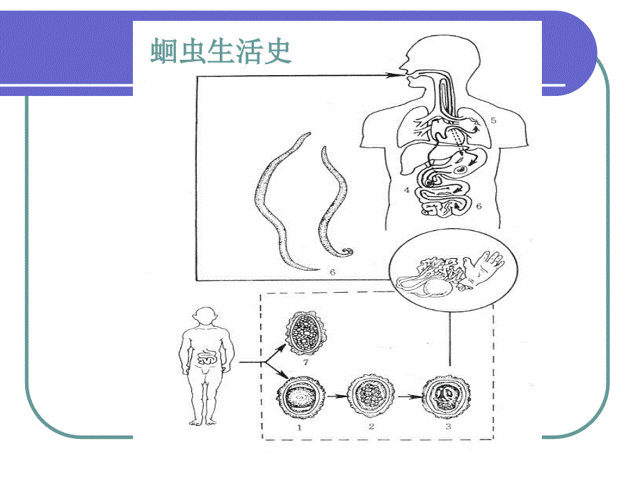 蛔虫病患者的护理课件_第3页