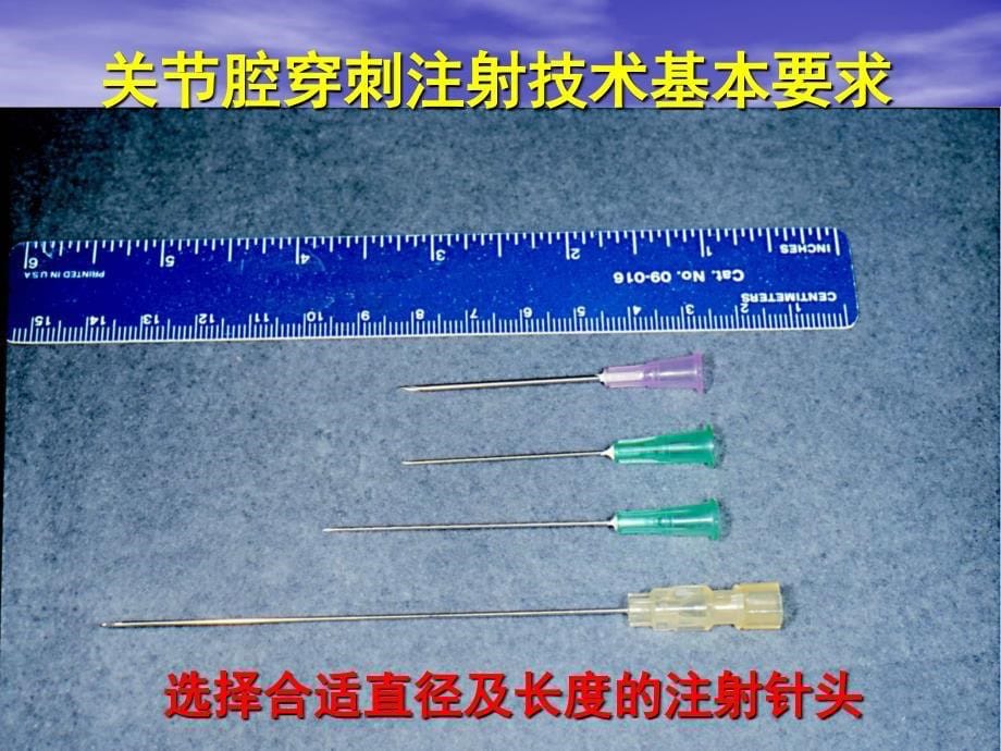 关节穿刺方法ppt课件_第5页