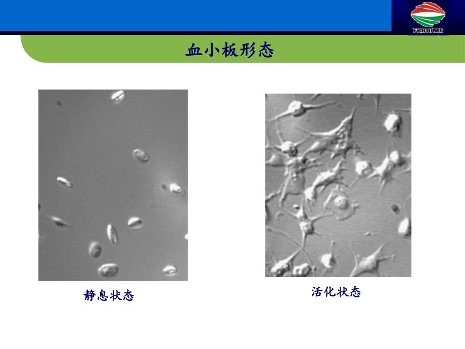 血小板抗原抗体检测及其在血液病科临床应用 ppt课件_第4页