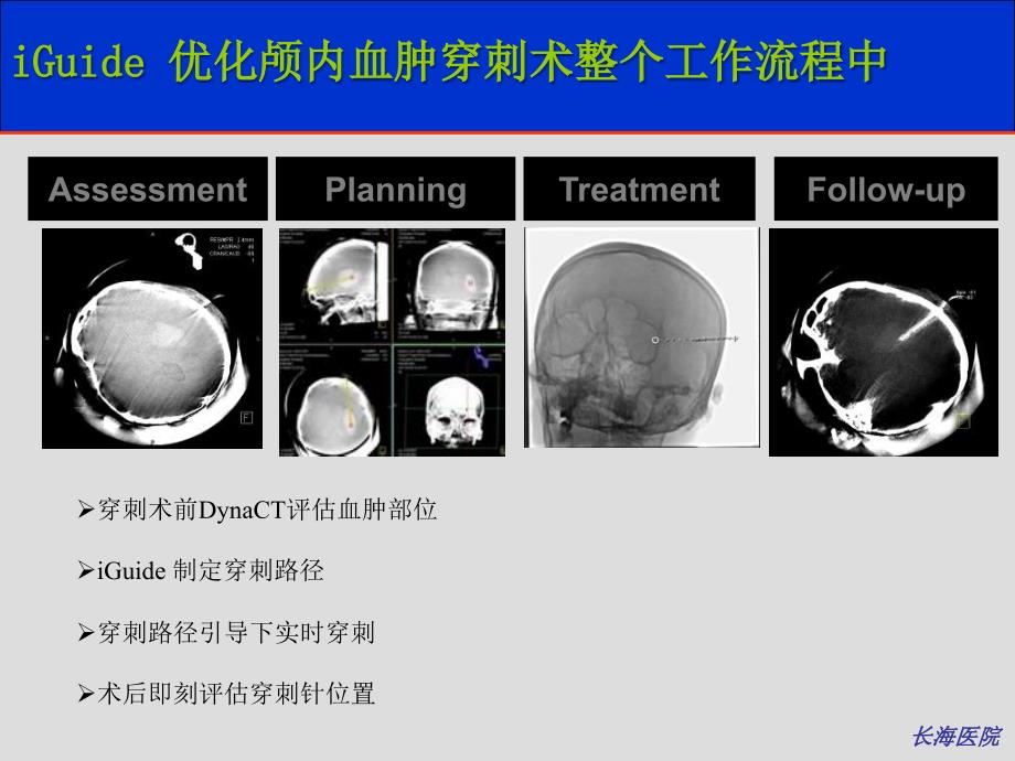 血管造影ct在神经介入治疗中的运用初步经验ppt课件_第4页