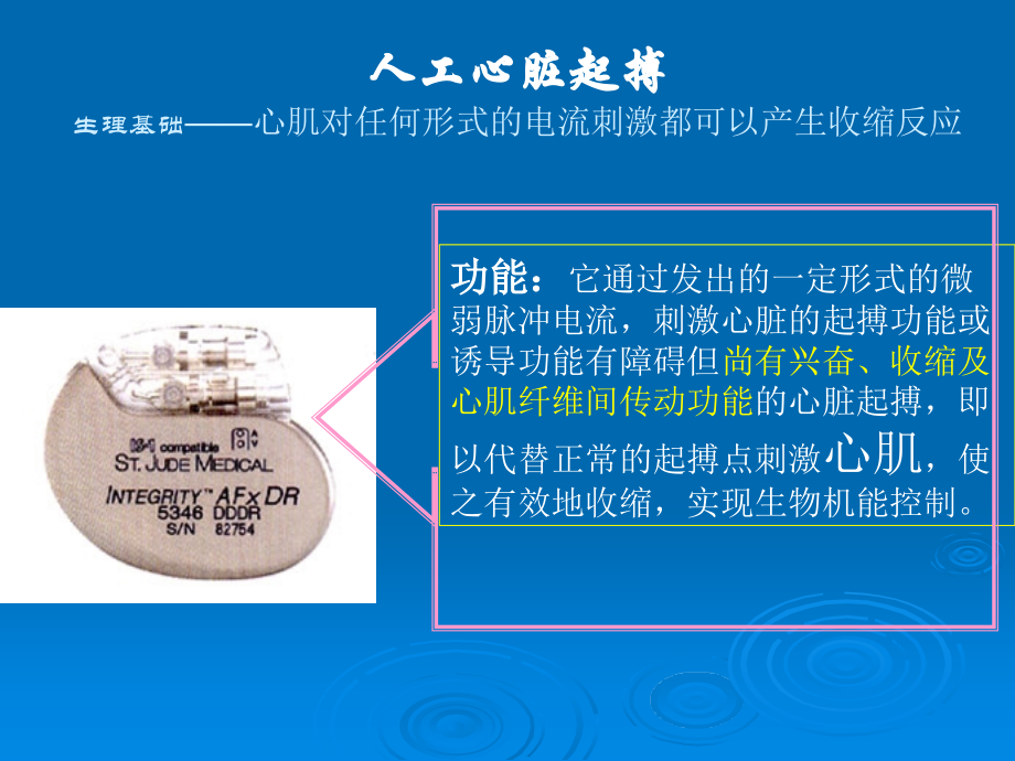 人工心脏起搏器ppt课件_第4页