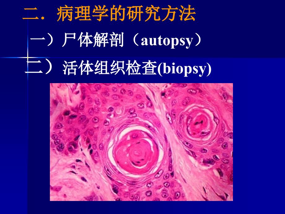 病理学第一章绪论47558幻灯片_第4页