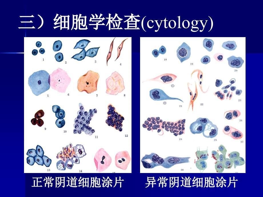 病理学第一章绪论47558幻灯片_第5页