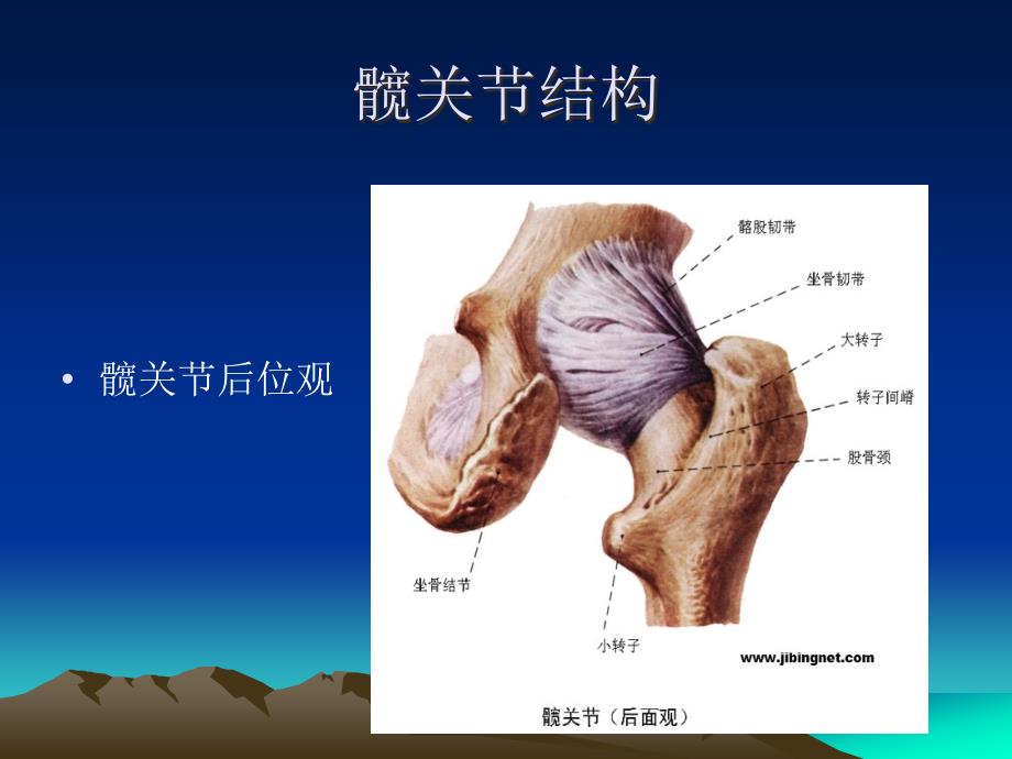 小切口全髋关节置换术入路及解剖课件_第3页