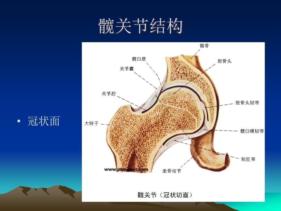 小切口全髋关节置换术入路及解剖课件_第5页