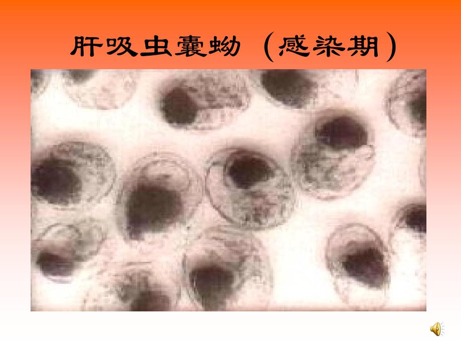 寄生虫（肝肺吸虫姜片虫）课件_第4页