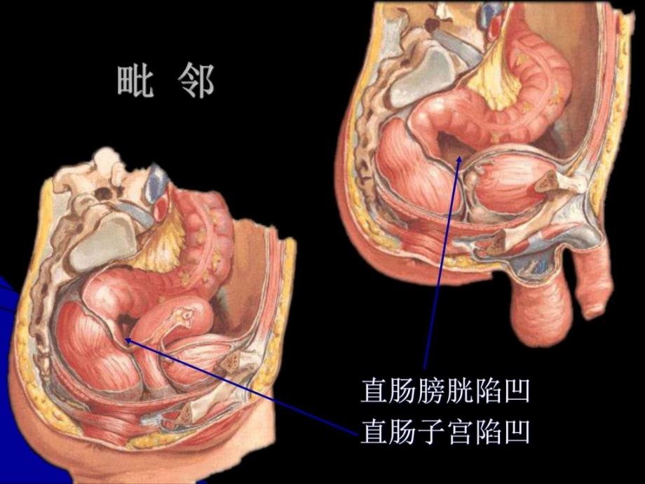 结直肠肛管解剖凌光烈 修改版图文课件_第4页