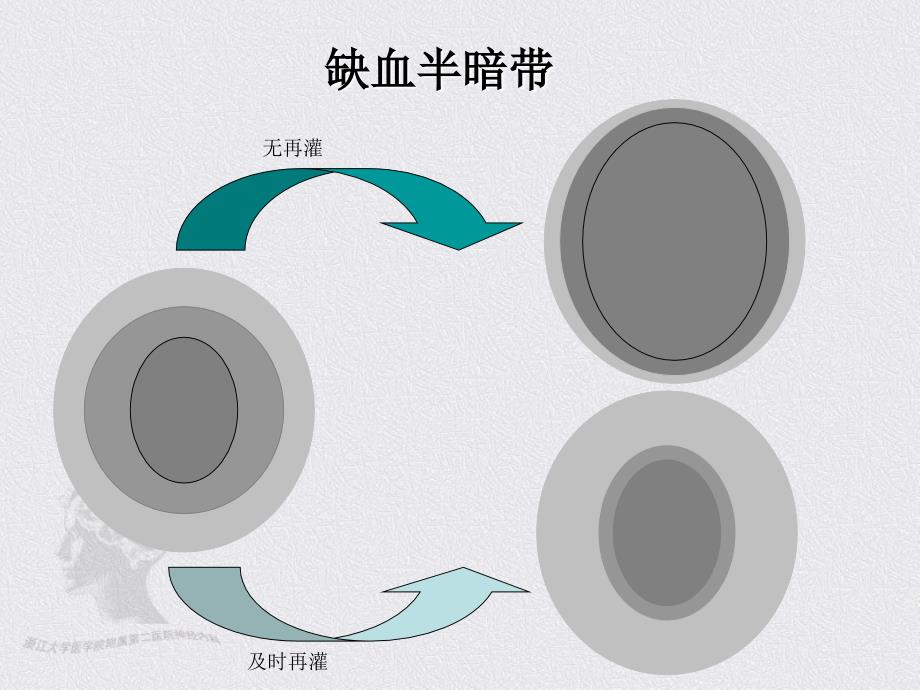 缺血性脑卒中急性期溶栓治疗进展楼敏课件_第4页