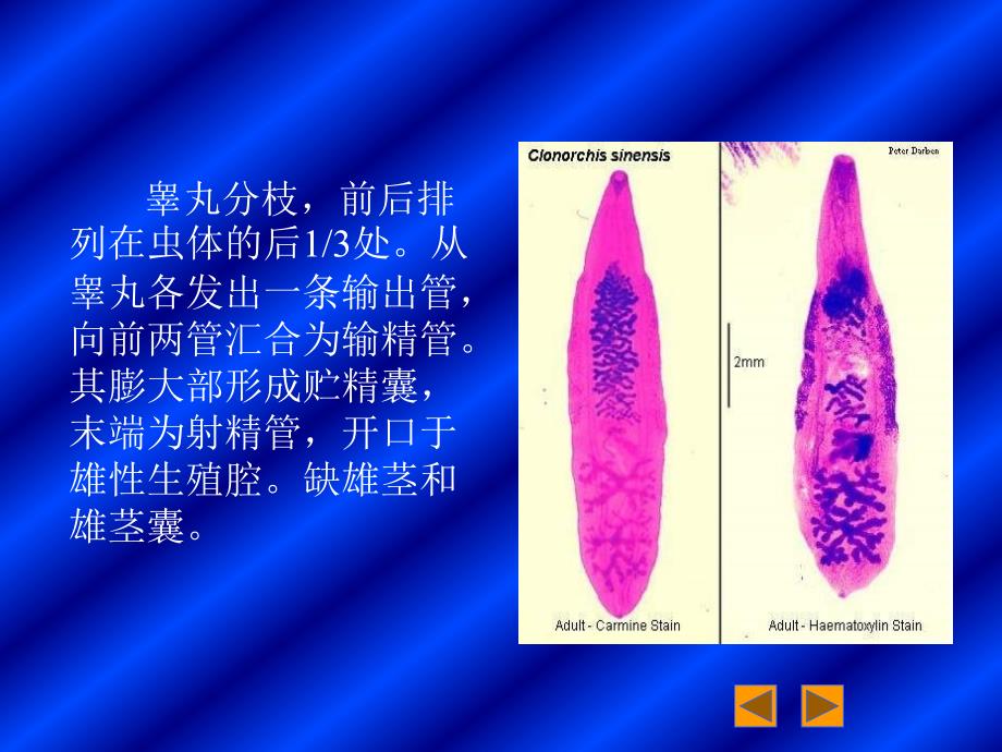 生物课件七华枝睾吸虫病_第4页