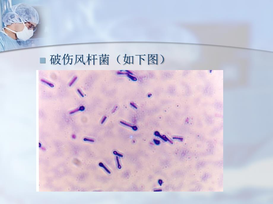 破伤风病人的护理课件_8_第3页