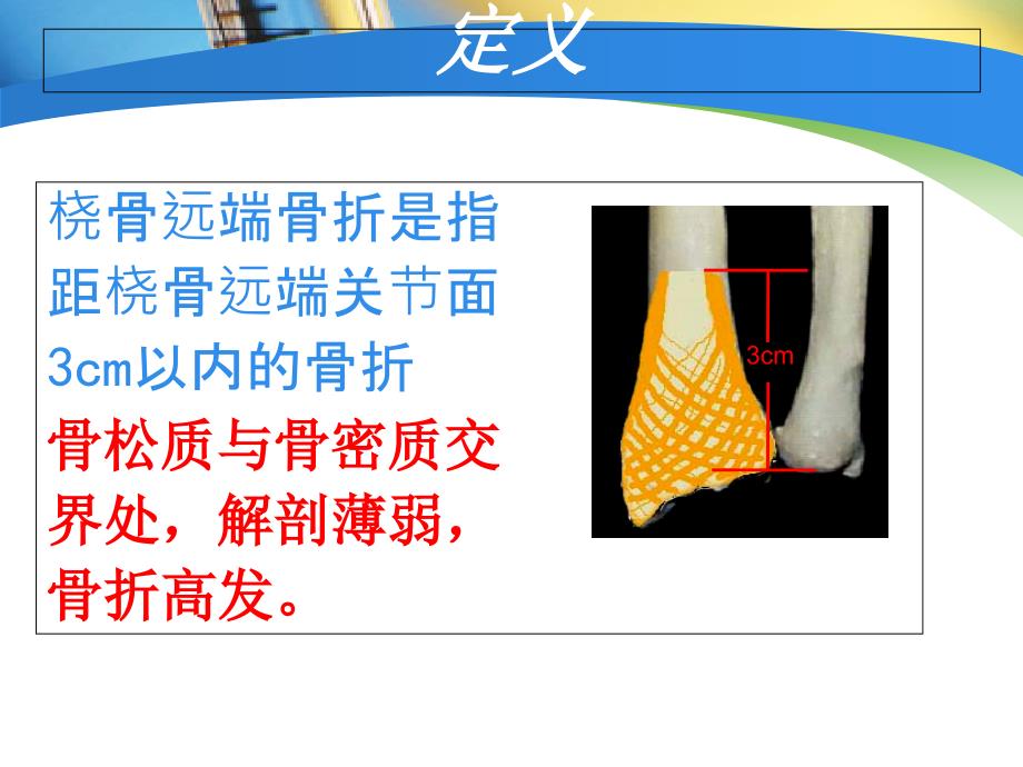 桡骨远端骨折经典教学课件_第3页