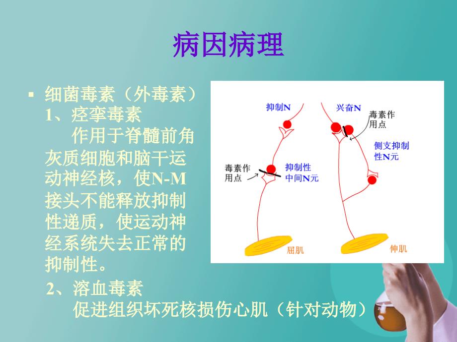 破伤风病人的护理课件_7_第4页