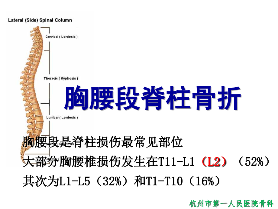 胸腰段脊柱骨折课件_第2页