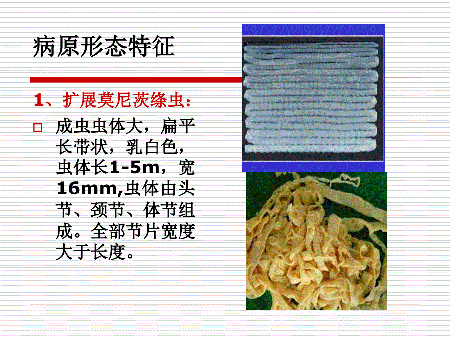 牛羊绦虫病课件_第3页