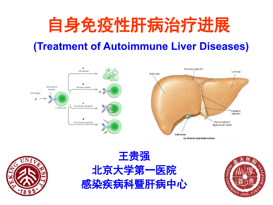 自身免疫性肝病治疗进展广西课件_2_第1页