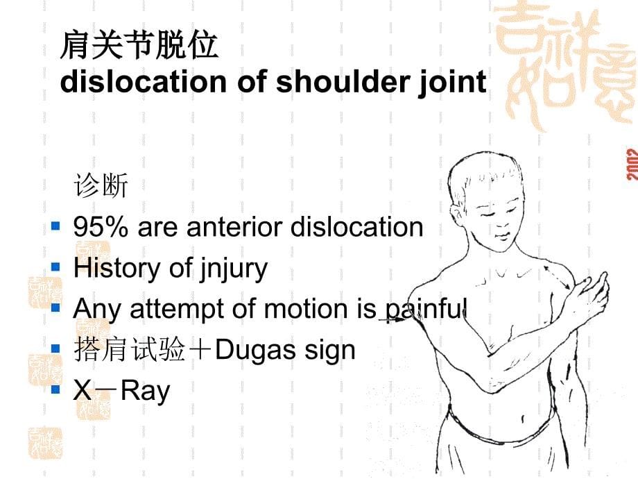 肩关节脱位课件_2_第5页