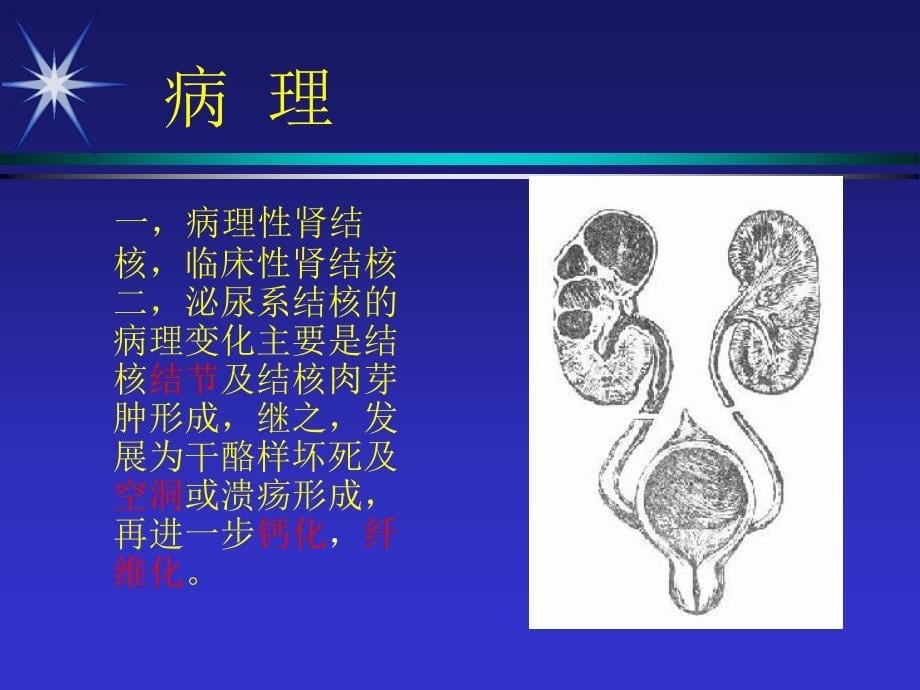 泌尿生殖系统结核2图文课件_第5页
