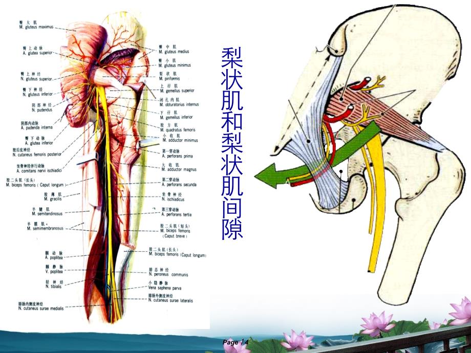 梨状肌综合征课件_8_第4页