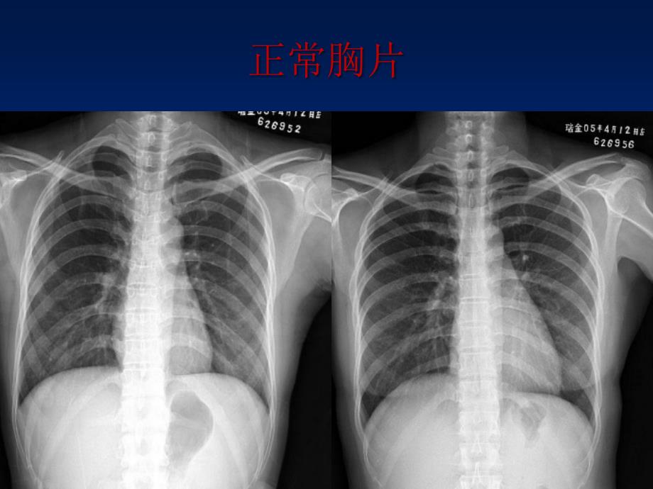 执业医师技能考试放射培训_第4页