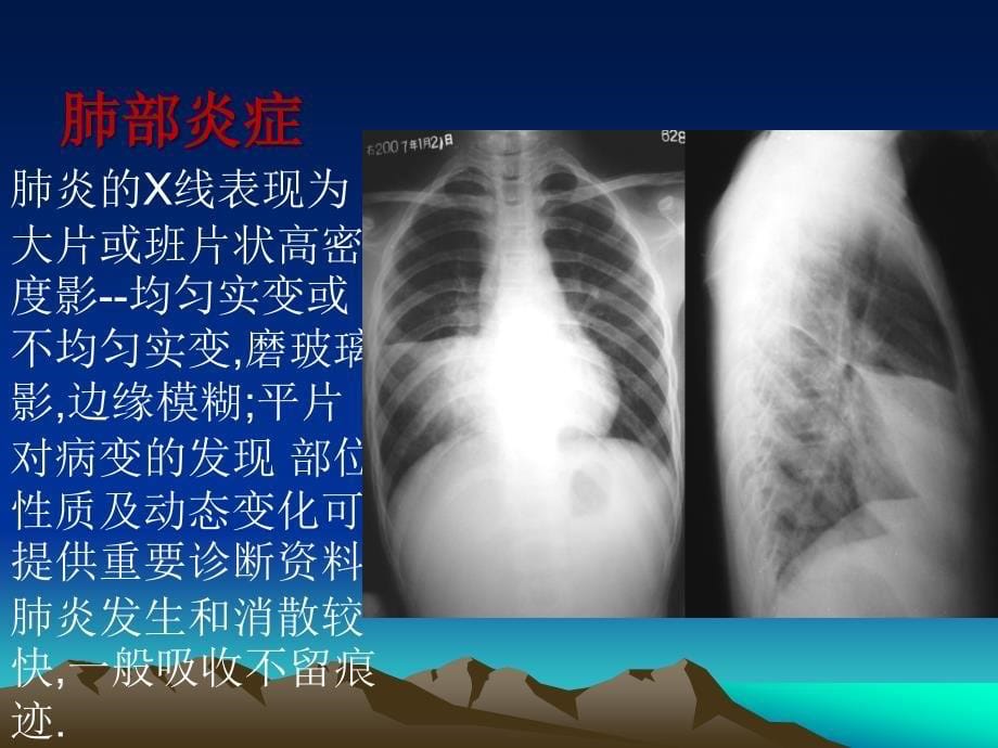 执业医师技能考试放射培训_第5页