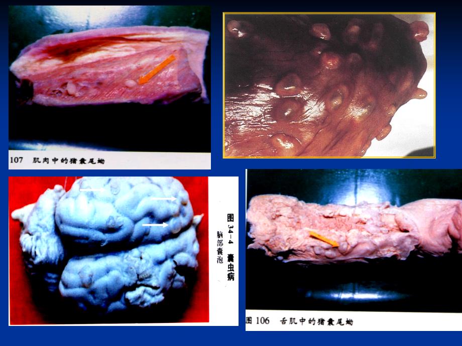 畜牧兽医猪囊尾蚴病课件_第3页