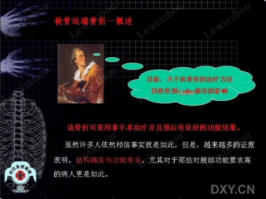 桡骨远端骨折课件_2_第3页