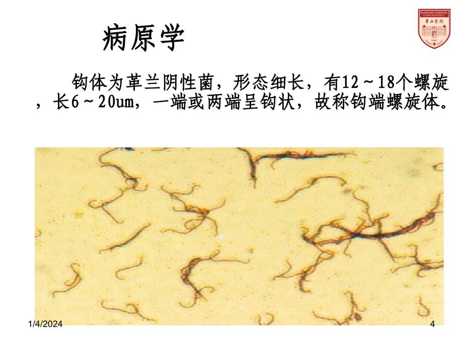 传染病学13钩端螺旋体病课件_第4页