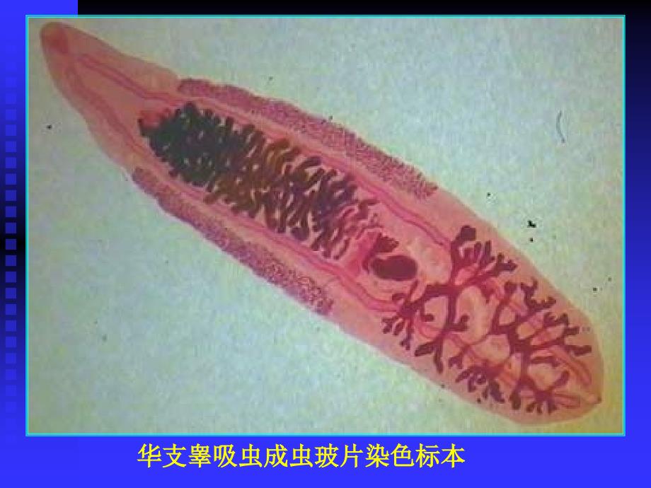 基础医学华支睾吸虫课件_第3页