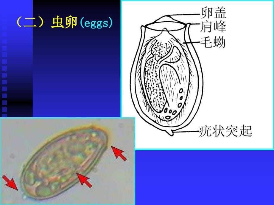 基础医学华支睾吸虫课件_第5页