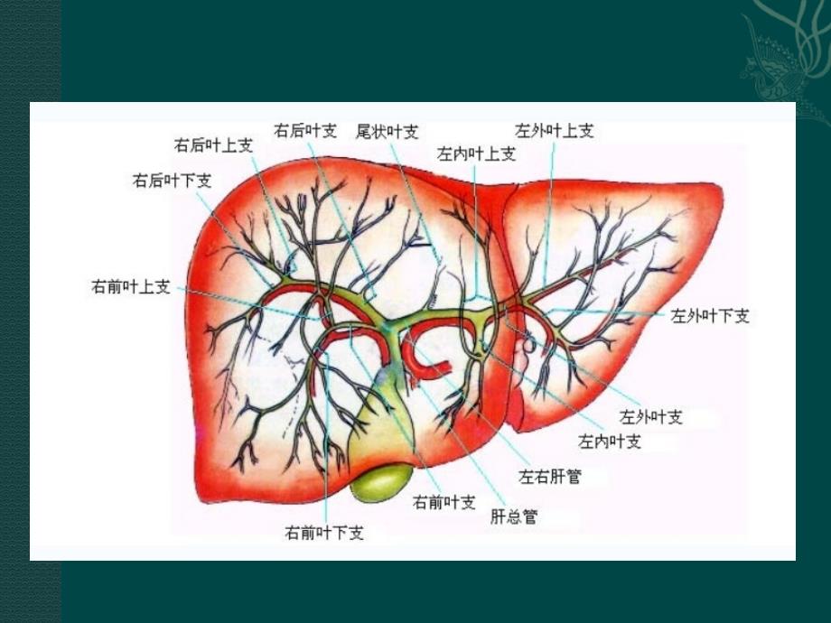 对梗阻性黄疸的诊断课件_第4页