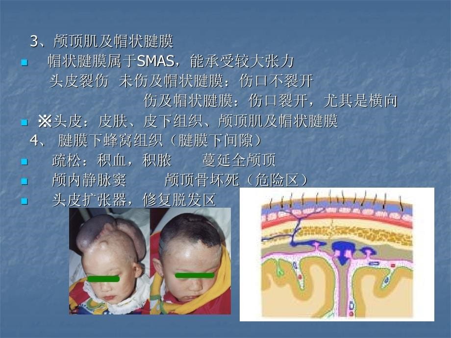 第六章颅部局部解剖课件_第5页