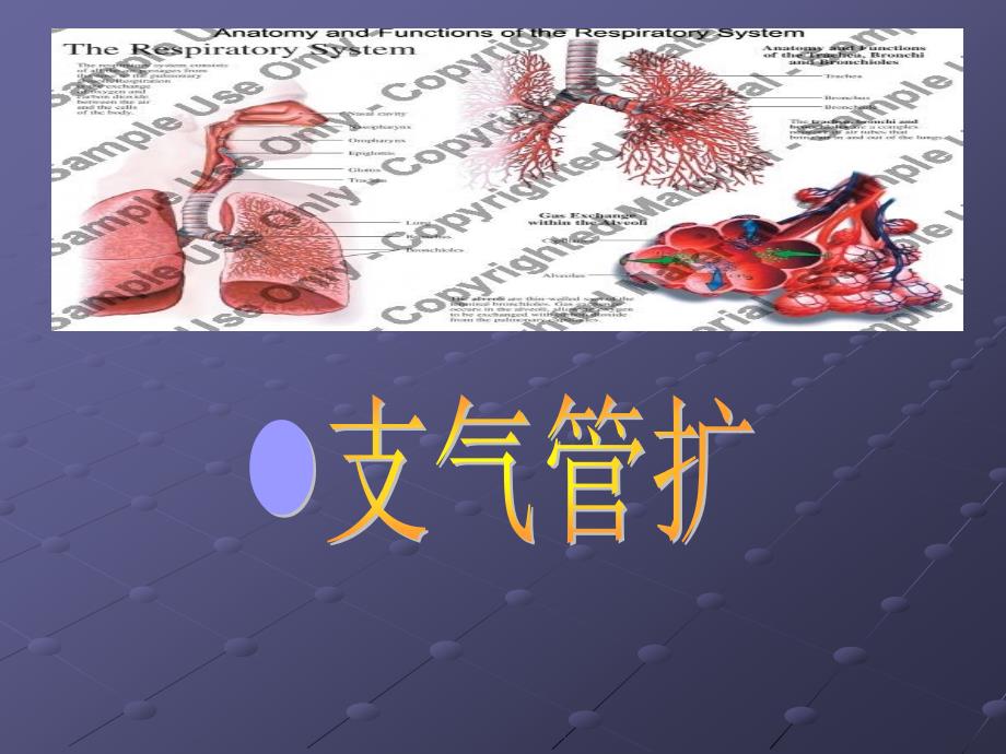 支气管扩张症护理查房资料课件_第1页