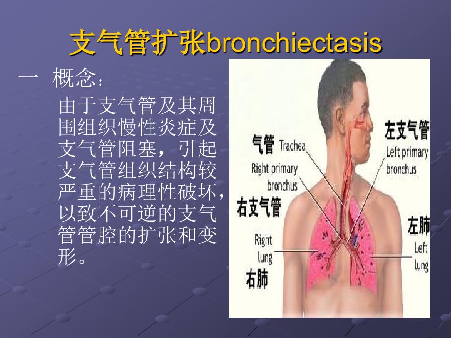 支气管扩张症护理查房资料课件_第2页