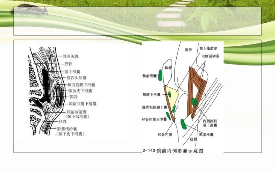 膝关节滑囊炎精要课件_第5页