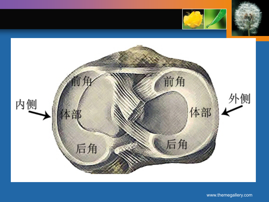 膝关节半月板及韧带损伤的mri表现课件_第3页