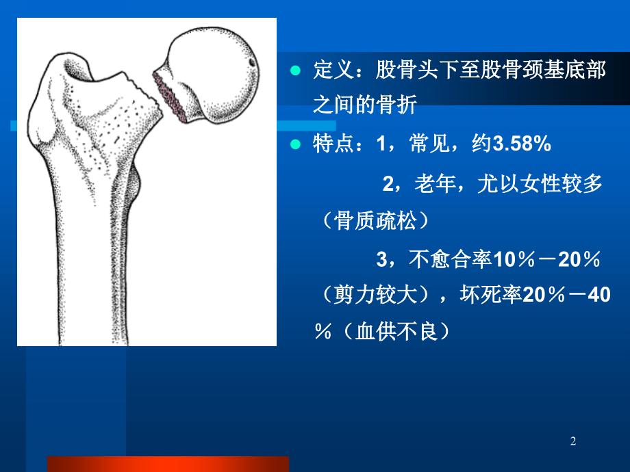 影像学股骨颈骨折课件_1_第2页