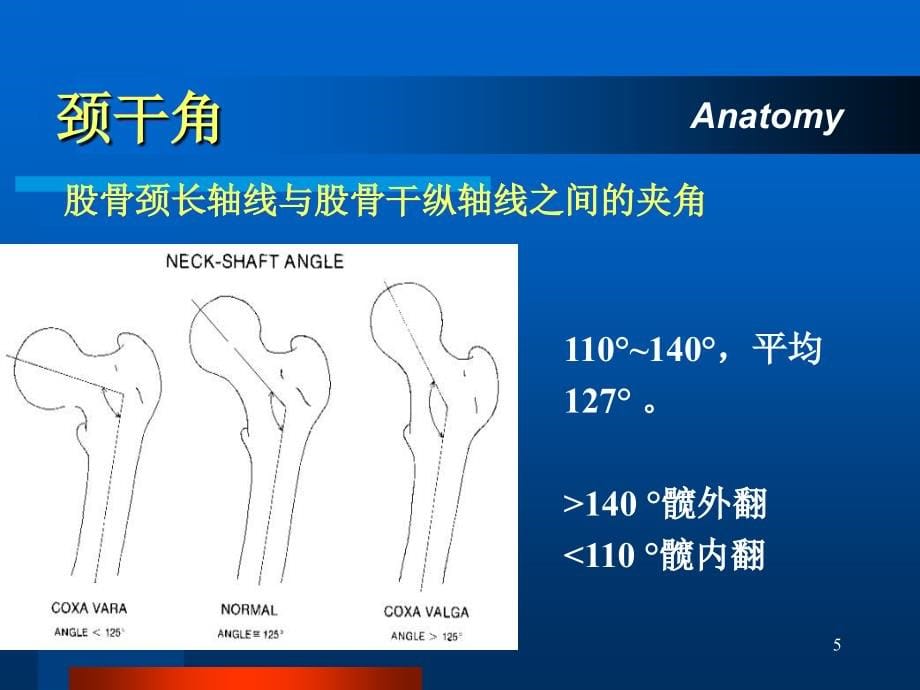 影像学股骨颈骨折课件_1_第5页