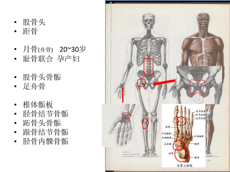 缺血骨坏死2012课件_第3页